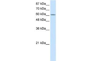 WB Suggested Anti-PRMT5 Antibody Titration:  2. (PRMT5 antibody  (N-Term))