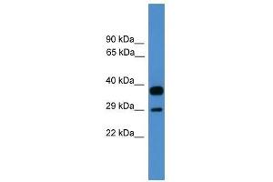 OTUB2 antibody used at 0. (OTUB2 antibody  (Middle Region))