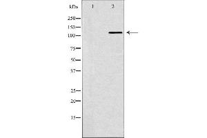 Western blot analysis of Hela whole cell lysates, using SMARCA5 Antibody. (SMARCA5 antibody  (C-Term))