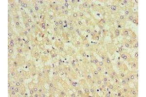 Immunohistochemistry of paraffin-embedded human liver tissue using ABIN7157655 at dilution of 1:100 (KIF6 antibody  (AA 565-814))