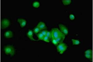 Immunofluorescent analysis of MCF-7 cells using ABIN7168469 at dilution of 1:100 and Alexa Fluor 488-congugated AffiniPure Goat Anti-Rabbit IgG(H+L) (RUSC1 antibody  (AA 231-433))