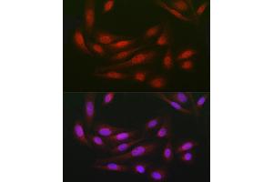 Immunohistochemistry (IHC) image for anti-DDB1 and CUL4 Associated Factor 7 (DCAF7) (AA 1-342) antibody (ABIN6139432)