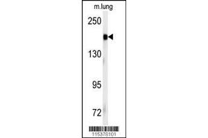 Image no. 1 for anti-Insulin Receptor (INSR) (Tyr1185) antibody (ABIN381200) (Insulin Receptor antibody  (Tyr1185))