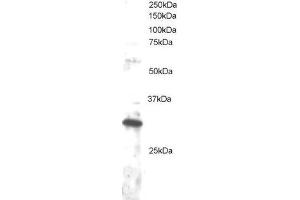 ABIN2562232 staining (1µg/ml) of Jurkat lysate (RIPA buffer, 30µg total protein per lane).