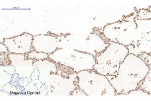 Immunohistochemistry (IHC) image for anti-Desmin (DES) antibody (ABIN5958489) (Desmin antibody)