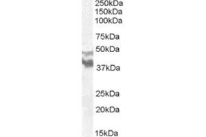 Western Blotting (WB) image for anti-Dyslexia Susceptibility 1 Candidate 1 (DYX1C1) (N-Term) antibody (ABIN2466680) (DYX1C1 antibody  (N-Term))