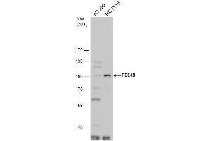 WB Image PDE4B antibody detects PDE4B protein by western blot analysis. (PDE4B antibody  (C-Term))