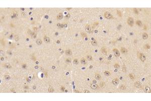 Detection of CAMLG in Mouse Cerebrum Tissue using Polyclonal Antibody to Calcium Modulating Ligand (CAMLG) (CAMLG antibody  (AA 1-187))