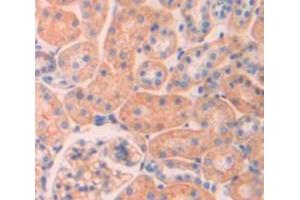 Immunohistochemistry (IHC) image for anti-Tumor Necrosis Factor Receptor Superfamily, Member 1A (TNFRSF1A) (AA 43-194) antibody (ABIN1174718)