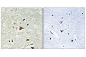 Immunohistochemistry (IHC) image for anti-SMAD, Mothers Against DPP Homolog 2 (SMAD2) (Thr220) antibody (ABIN7180083)