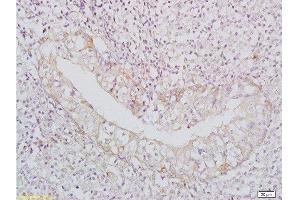 Immunohistochemistry (Paraffin-embedded Sections) (IHC (p)) image for anti-Tumor Necrosis Factor (Ligand) Superfamily, Member 13b (TNFSF13B) (AA 221-309) antibody (ABIN740175)
