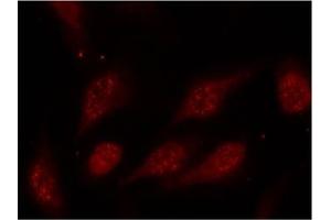 Image no. 2 for anti-Tumor Protein P53 (TP53) (pSer315) antibody (ABIN196788) (p53 antibody  (pSer315))