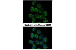 ICC/IF Image Immunofluorescence analysis of paraformaldehyde-fixed A431, using alpha Dystroglycan, antibody at 1:500 dilution. (Dystroglycan antibody)