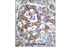 Immunohistochemistry analysis in Formalin Fixed, Paraffin Embedded Human pancreas tissue stained with SEMA3G antibody (Center) followed by peroxidase conjugation of the secondary antibody and DAB staining. (SEMA3G antibody  (Middle Region))