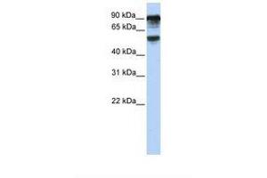 Image no. 1 for anti-TBC1 Domain Family, Member 10B (TBC1D10B) (AA 720-769) antibody (ABIN6739066) (TBC1D10B antibody  (AA 720-769))