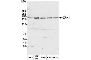 Western Blotting (WB) image for anti-5'-3' Exoribonuclease 1 (XRN1) (C-Term) antibody (ABIN7450913) (XRN1 antibody  (C-Term))