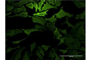Immunofluorescence of monoclonal antibody to RASA1 on HeLa cell. (RASA1 antibody  (AA 948-1047))