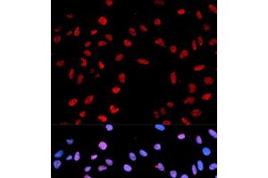 Immunofluorescence analysis of MCF-7 cells using Phospho-AKT(T450) Polyclonal Antibody (AKT1 antibody  (pThr450))