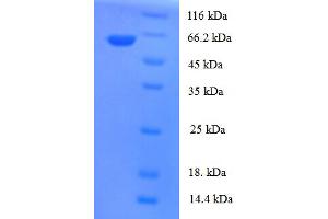 SDS-PAGE (SDS) image for Tubulin Folding Cofactor E-Like (TBCEL) (AA 1-424), (full length) protein (His-SUMO Tag) (ABIN5711401)