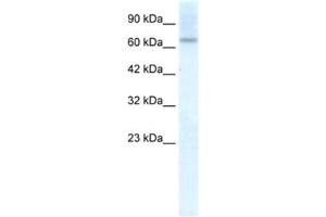 Western Blotting (WB) image for anti-Protein Inhibitor of Activated STAT, 2 (PIAS2) antibody (ABIN2461198) (PIAS2 antibody)