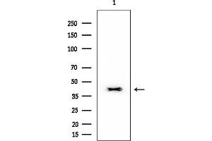 Western blot analysis of lysates from EC304 cells, using EDG3 Mouse Monoclonal Antibody at 1/1000 dilution.