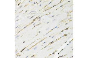 Immunohistochemistry of paraffin-embedded mouse heart using ANXA2 antibody. (Annexin A2 antibody)
