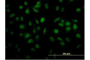Immunofluorescence of monoclonal antibody to TOE1 on HeLa cell. (TOE1 antibody  (AA 1-510))