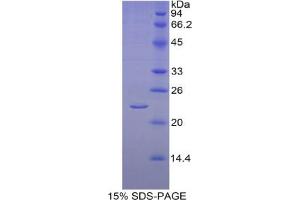 SDS-PAGE analysis of Human Aromatase Protein. (Aromatase Protein)