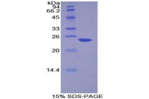 Non Metastatic Cells 6, Protein Expressed In protein