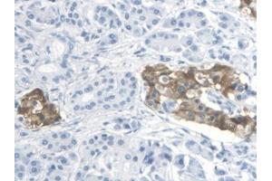 Immunohistochemistry (IHC) image for anti-Thromboxane A2 Receptor (TBXA2R) (AA 3-324) antibody (ABIN7435151)