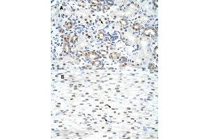 Immunohistochemical staining (Formalin-fixed paraffin-embedded sections) of (A) human kidney and (B) human heart tissues with LSM2 polyclonal antibody . (LSM2 antibody  (AA 46-95))