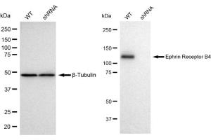 Western blotting analysis using Ephrin Receptor B4 antibody (ABIN7798459). (Recombinant Ephrin Receptor B4 antibody)