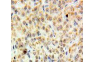 Used in DAB staining on fromalin fixed paraffin-embedded Ovary tissue (DDB2 antibody  (AA 166-383))