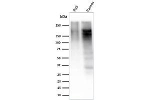 Western Blot Analysis of Raji and Ramos cell lysate using Ki67 Mouse Monoclonal Antibody (MKI67/2463).