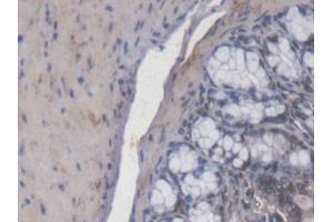 IHC-P analysis of Mouse Colon Tissue, with DAB staining.