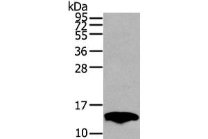 Western Blot analysis of Mouse fat tissue using PMP2 Polyclonal Antibody at dilution of 1/400 (PMP2 antibody)