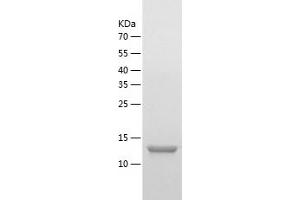 Western Blotting (WB) image for Hect Domain and RLD 3 (HERC3) (AA 232-358) protein (His tag) (ABIN7123282) (HERC3 Protein (AA 232-358) (His tag))