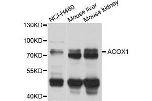 Western blot analysis of extract of various cells, using ACOX1 antibody.