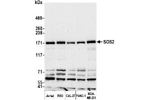 anti-Son of Sevenless Homolog 2 (SOS2) (AA 1282-1332) antibody