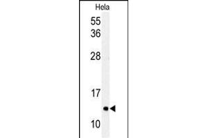 Western blot analysis of G8c (M1LC3C) Antibody (T48) 1804e in Hela cell line lysates (35 μg/lane). (MAP1LC3A antibody  (AA 27-57))