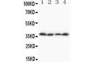 Anti-Stra8 antibody, Western blotting Lane 1: A231 Cell Lysate Lane 2: JURKAT Cell Lysate Lane 3:  Cell Lysate Lane 4: SCG Cell Lysate (STRA8 antibody  (C-Term))