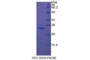 SDS-PAGE (SDS) image for Insulin-Like Growth Factor Binding Protein 6 (IGFBP6) (AA 51-226) protein (His tag) (ABIN2125305)