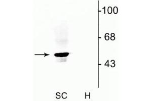 Western blot of rat spinal cord lysate (SC) showing specific immunolabeling of the ~48 kDa α1- and α2-subunits of the glycine receptor. (GLRA1 antibody  (N-Term))