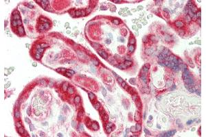 Rabbit Anti-TRIantibody  Formalin Fixed Paraffin Embedded Tissue: Human Placenta Primary antibody Concentration: 1:100 Secondary Antibody: Donkey anti-Rabbit-Cy3 Secondary Antibody Concentration: 1:200 Magnification: 20x Exposure Time: 0. (TRIP10 antibody  (N-Term))