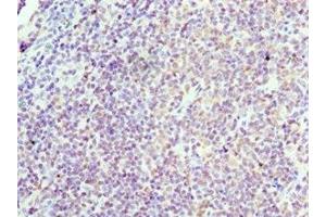 Immunohistochemistry of paraffin-embedded human tonsil tissue using ABIN7153394 at dilution of 1:100 (Cyclin D3 antibody  (AA 1-292))