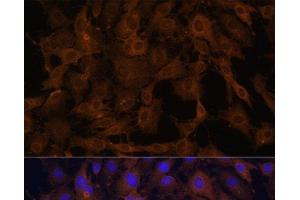 Immunofluorescence analysis of C6 cells using BID Polyclonal Antibody at dilution of 1:100. (BID antibody)