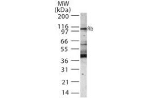 Western Blotting (WB) image for anti-Retinoblastoma Protein (Rb Protein) (AA 251-268) antibody (ABIN233206) (Retinoblastoma Protein (Rb) antibody  (AA 251-268))