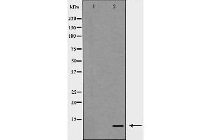 Western blot analysis of S100 A10 expression in COLO cells,The lane on the left is treated with the antigen-specific peptide. (S100A10 antibody  (Internal Region))