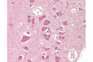 Anti-TSG / TWSG1 antibody IHC staining of human brain, cortex. (TWSG1 antibody  (AA 1-223))
