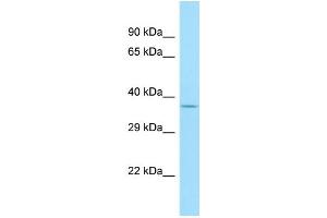 Host: Rabbit Target Name: OR1A2 Sample Type: MCF7 Whole Cell lysates Antibody Dilution: 1.